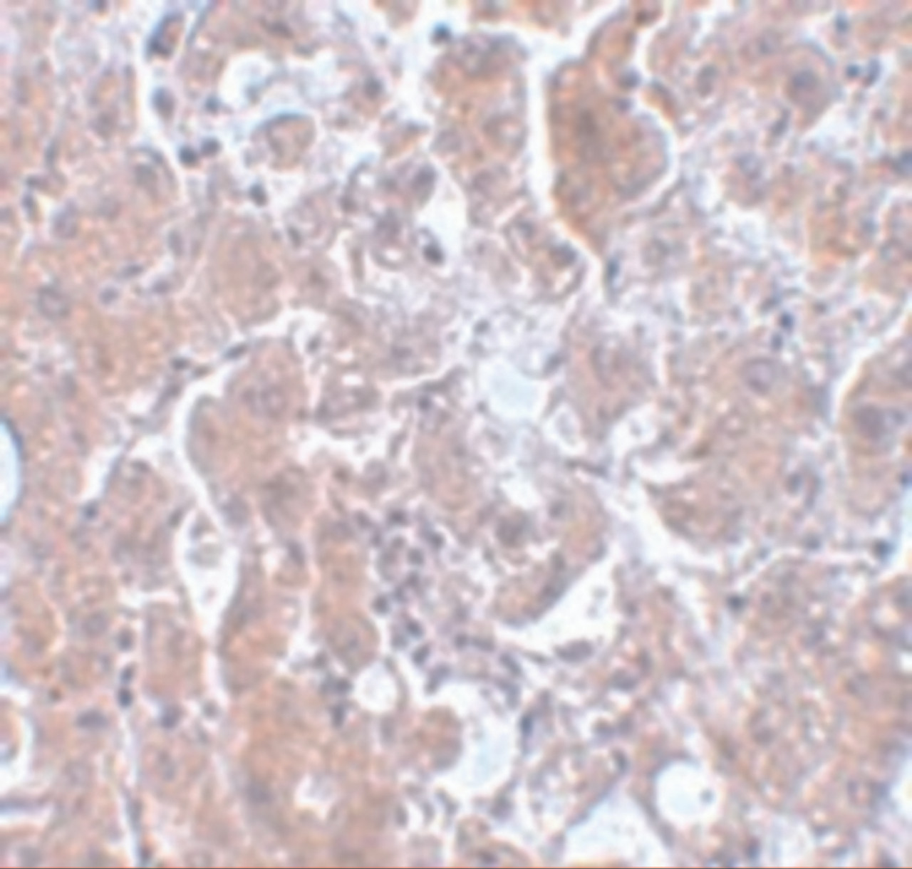 Immunohistochemistry of ELOVL7 in human liver tissue with ELOVL7 antibody at 5 ug/mL.