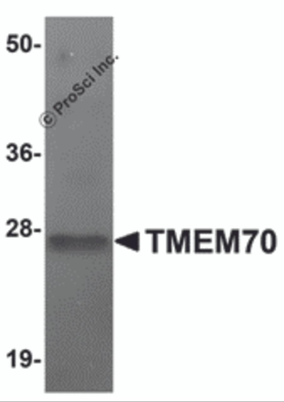 Western blot analysis of TMEM70 in human liver tissue lysate with TMEM70 antibody at 1 &#956;g/mL.