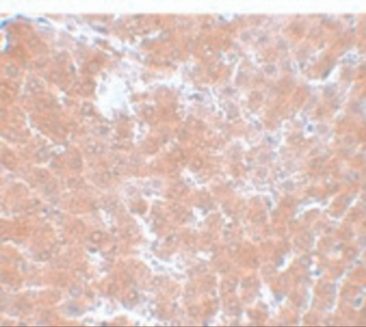 Immunohistochemistry of TMEM70 in rat liver tissue with TMEM70 antibody at 5 ug/mL.