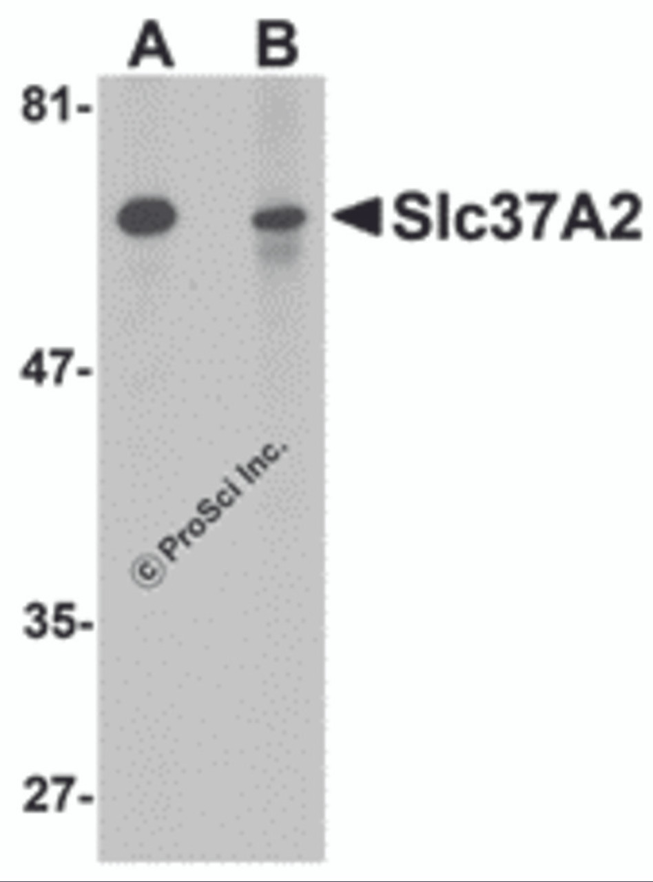 Western blot analysis of Slc37A2 in mouse spleen tissue lysate with Slc37A2 antibody at 1 &#956;g/mL in the (A) absence and (B) presence of blocking peptide.