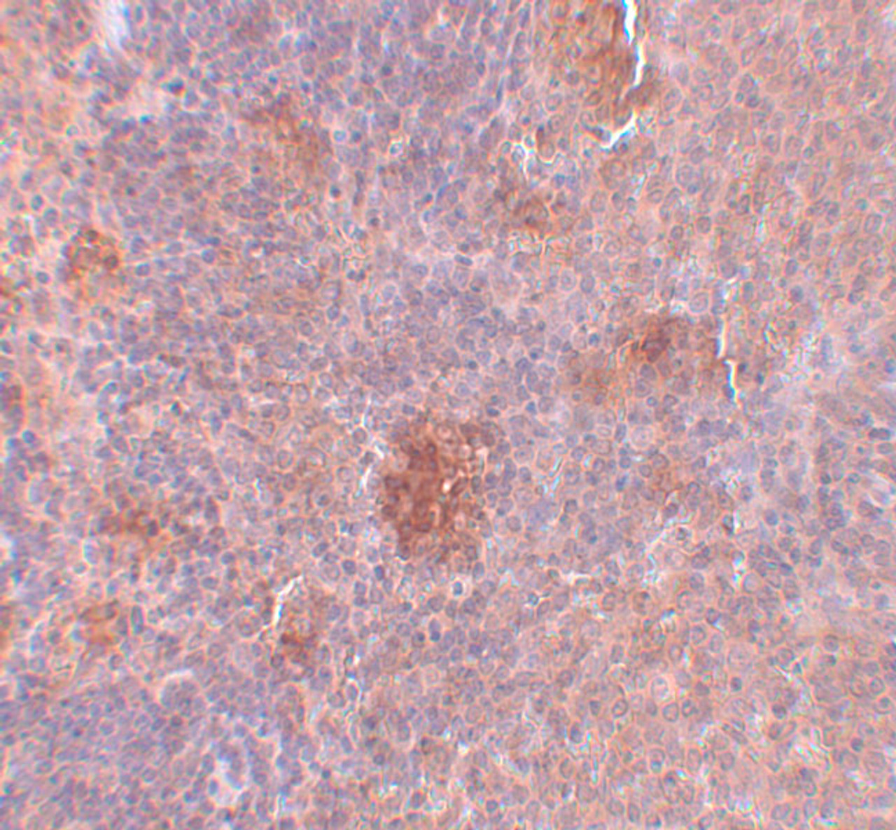 Immunohistochemistry of Slc37A2 in rat spleen tissue with Slc37A2 antibody at 5 ug/mL.