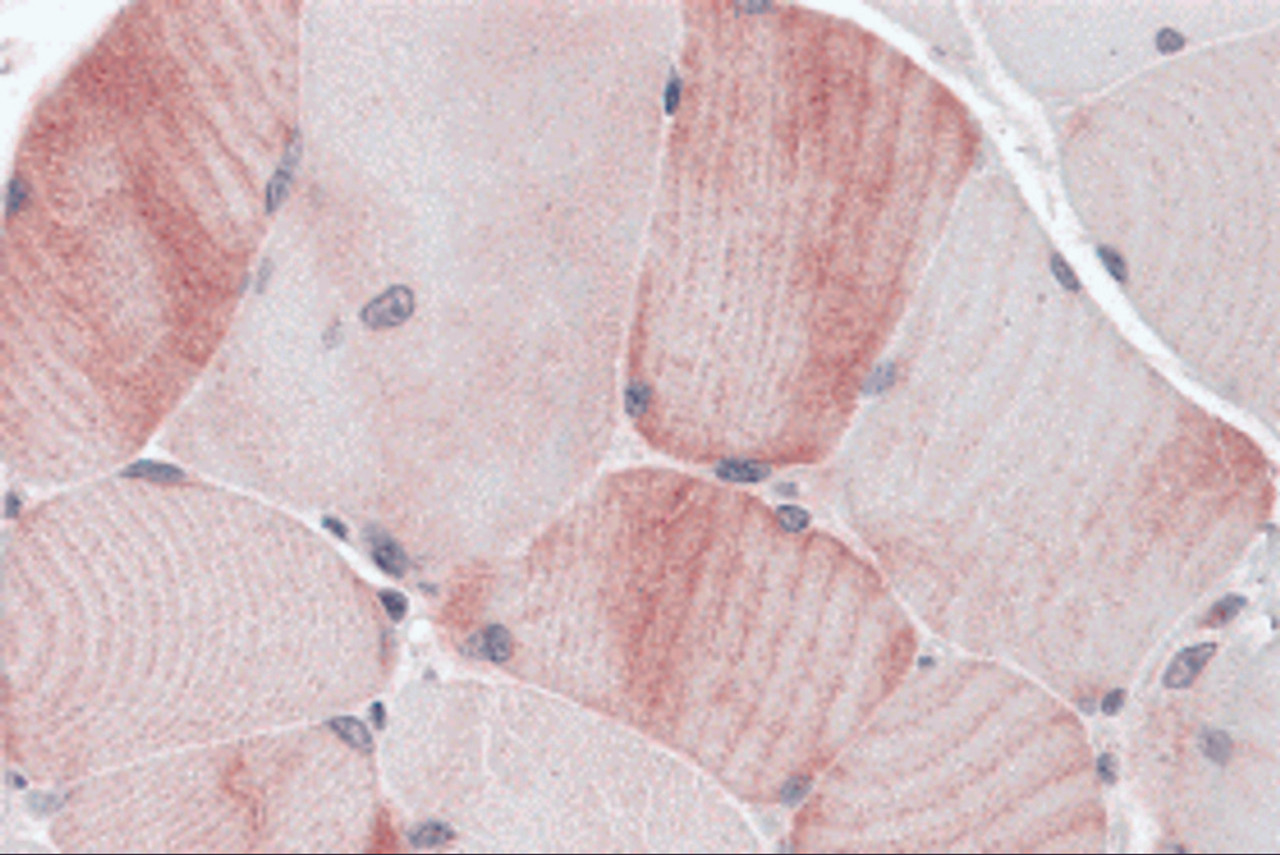 Immunohistochemistry of MYBPC1 in human skeletal muscle tissue with MYBPC1 antibody at 5 &#956;g/mL.