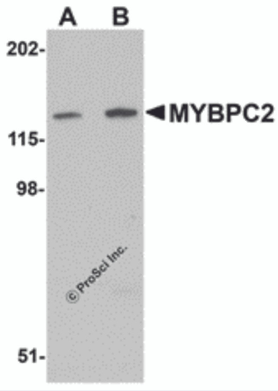 Western blot analysis of MYBPC2 in mouse skeletal muscle tissue lysate with MYBPC2 antibody at (A) 1 and (B) 2 &#956;g/mL.