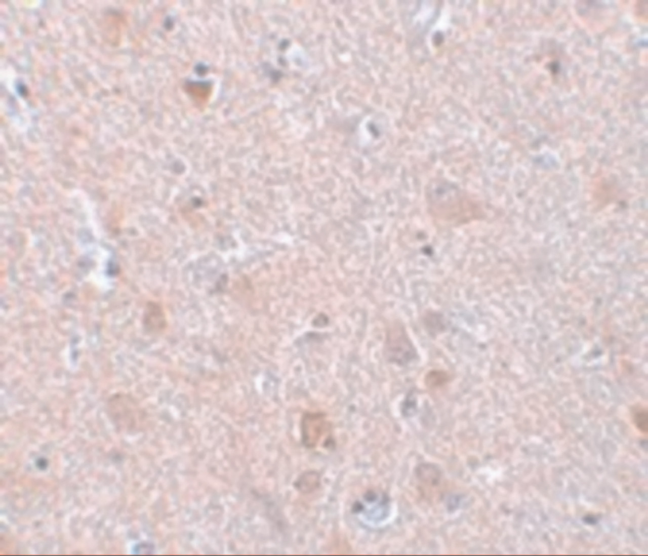 Immunohistochemistry of EFHD2 in human brain tissue with EFHD2 antibody at 5 ug/mL.