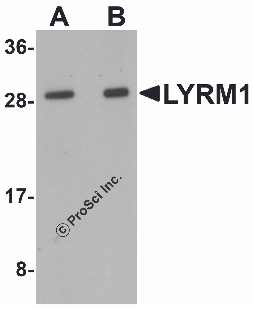 Western blot analysis of LYRM1 in human liver tissue lysate with LYRM1 antibody at (A) 1 and (B) 2 &#956;g/mL.