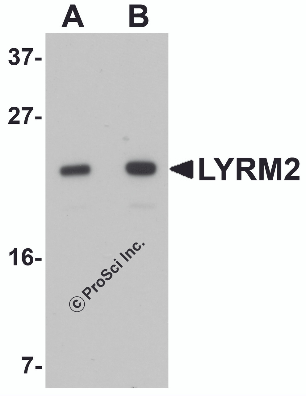 Western blot analysis of LYRM2 in A549 cell lysate with LYRM2 antibody at (A) 1 and (B) 2 &#956;g/mL.