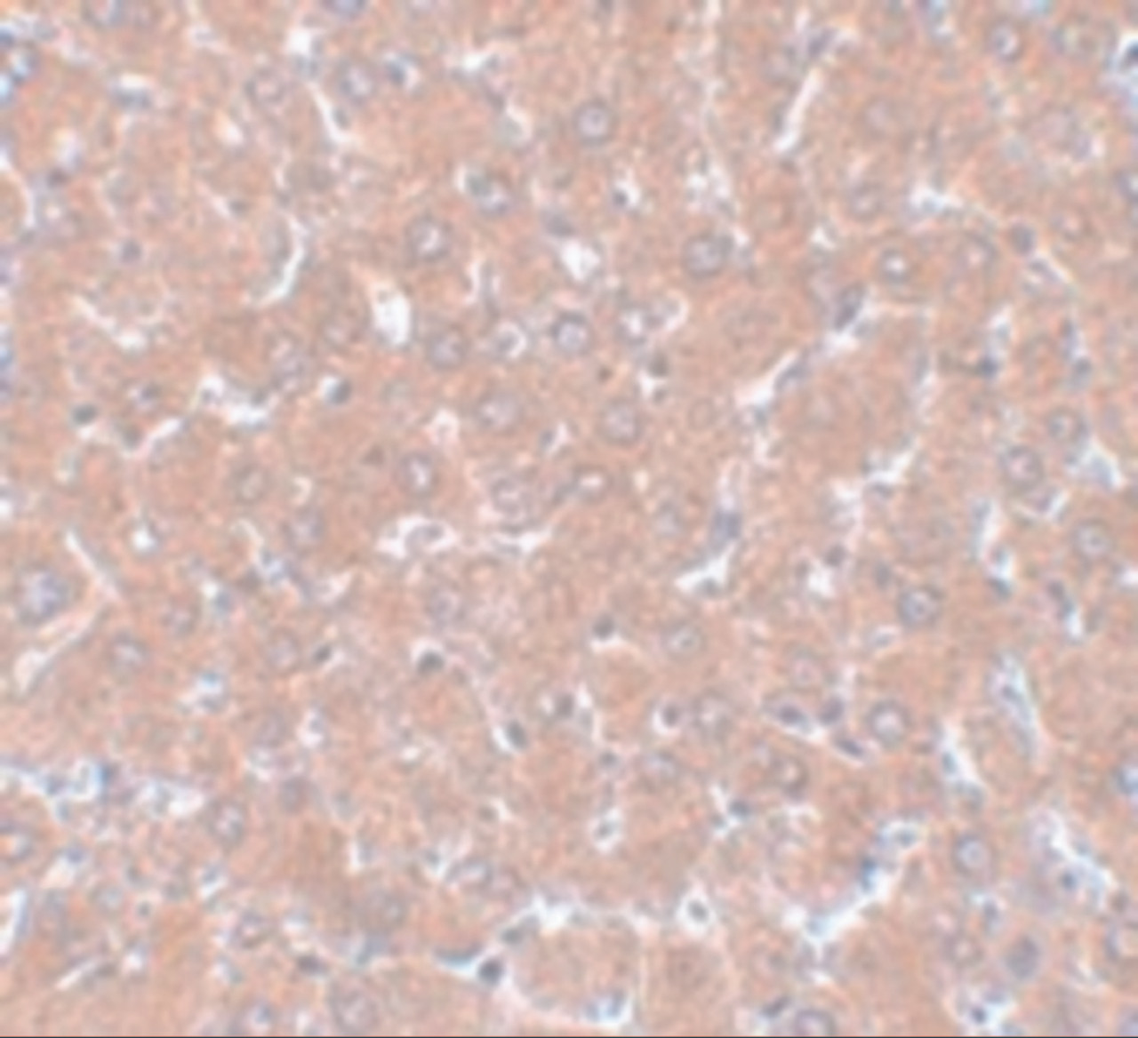 Immunohistochemistry of NSA1 in rat liver tissue with NSA1 antibody at 5 ug/mL.