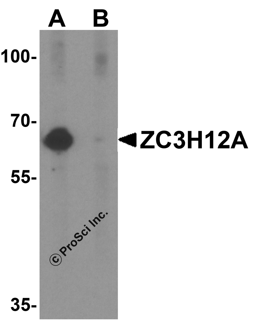 Western blot analysis of ZC3H12A in K562 cell lysate with ZC3H12A antibody at 1 &#956;g/mL in (A) the absence and (B) the presence of blocking peptide.