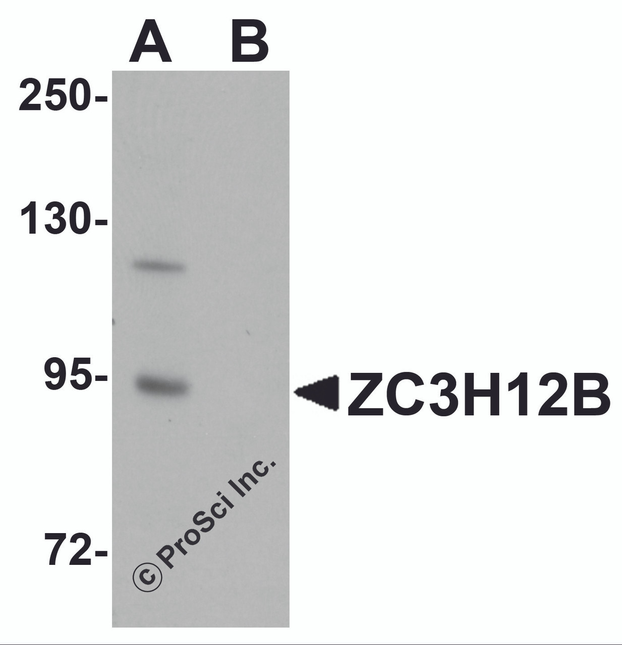 Western blot analysis of ZC3H12B in mouse brain tissue lysate with ZC3H12B antibody at 1 &#956;g/mL in (A) the absence and (B) the presence of blocking peptide.