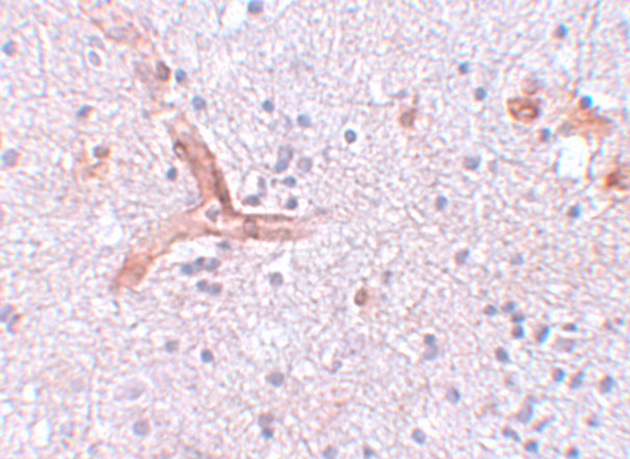 Immunohistochemistry of ZC3H12C in human brain tissue with ZC3H12C antibody at 5 ug/mL.