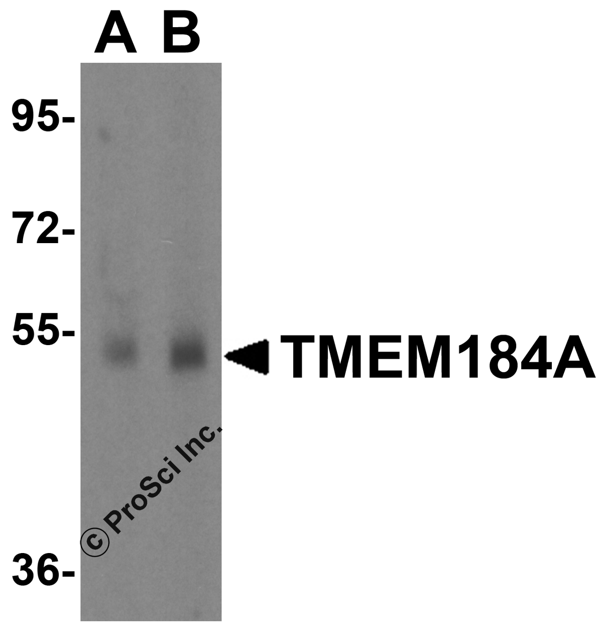 Western blot analysis of TMEM184A in human placenta tissue lysate with TMEM184A antibody at 1 &#956;g/mL in (A) the absence and (B) the presence of blocking peptide.