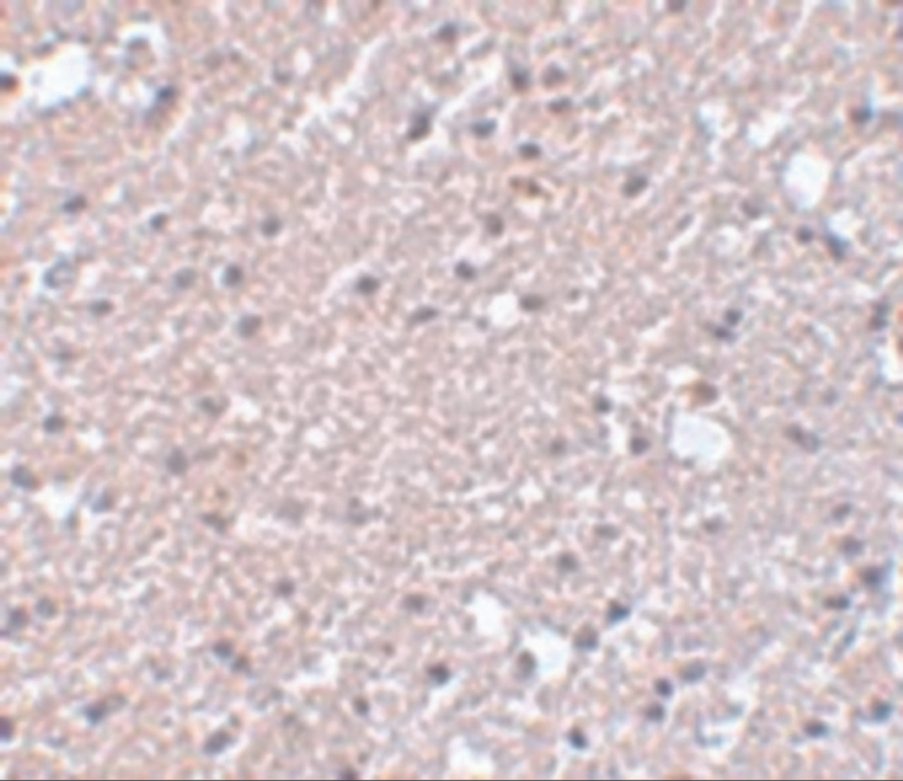 Immunohistochemistry of TMEM184A in human brain tissue with TMEM184A antibody at 5 ug/mL.