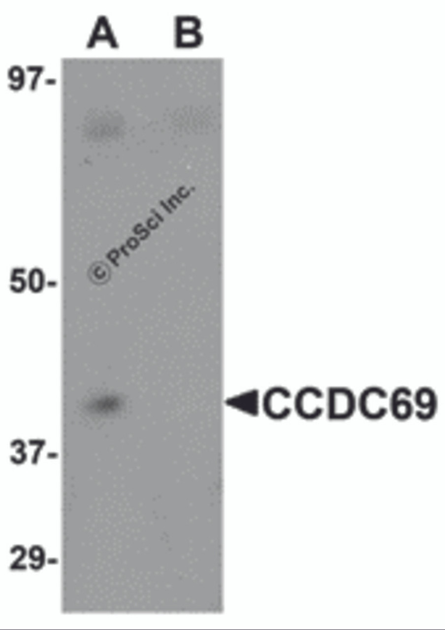 Western blot analysis of CCDC69 in mouse lung tissue lysate with CCDC69 antibody at 1 &#956;g/mL in (A) the absence and (B) the presence of blocking peptide.