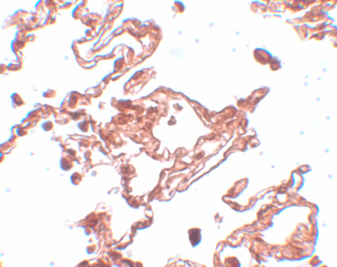 Immunohistochemistry of CCDC69 in human lung tissue with CCDC69 antibody at 5 ug/mL.