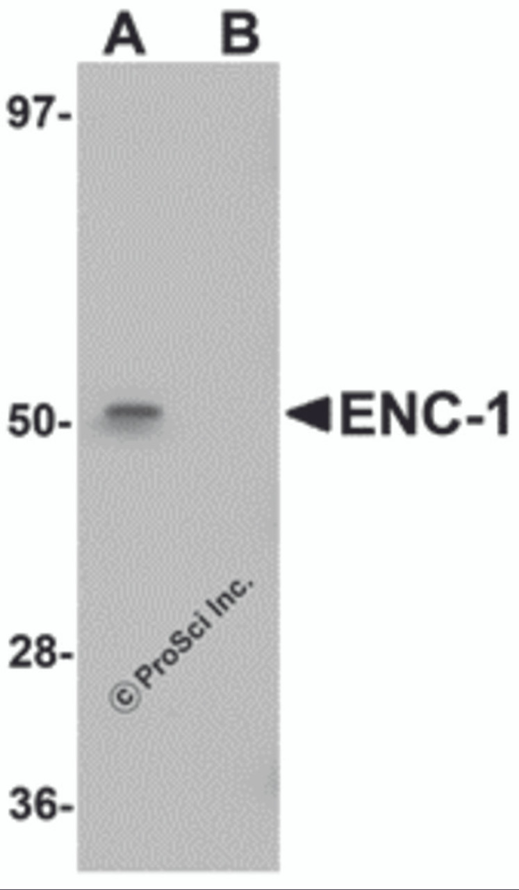 Western blot analysis of ENC-1 in mouse kidney muscle tissue lysate with ENC-1 antibody at 1 &#956;g/mL in (A) the absence and (B) the presence of blocking peptide.