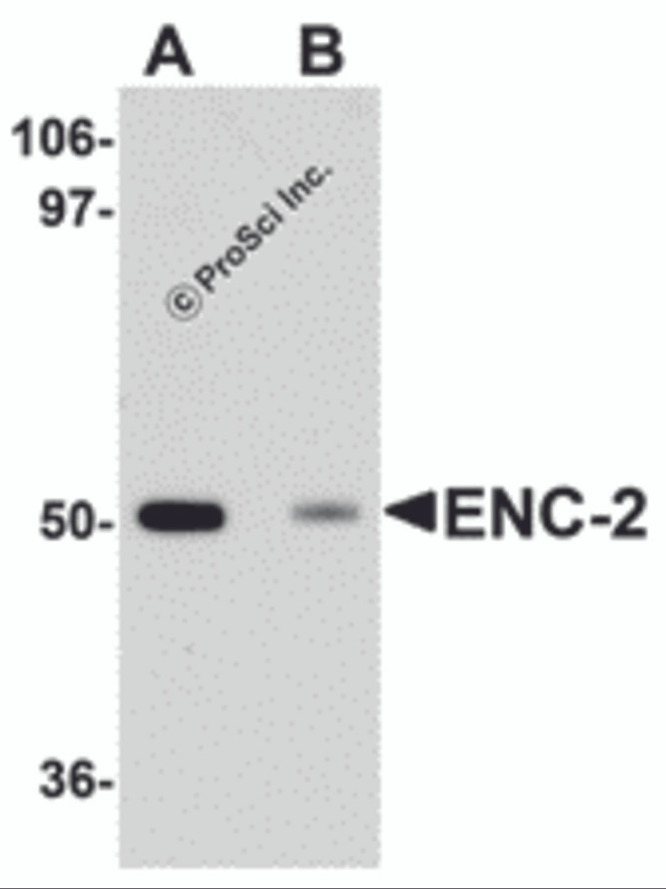 Western blot analysis of ENC-2 in Jurkat cell lysate with ENC-2 antibody at 1 &#956;g/mL in (A) the absence and (B) the presence of blocking peptide.