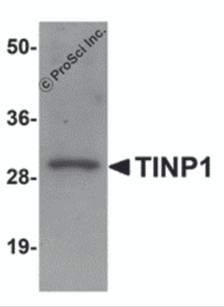 Western blot analysis of TINP1 in rat brain tissue lysate with TINP1 antibody at (A) 1 and (B) 2 &#956;g/mL.