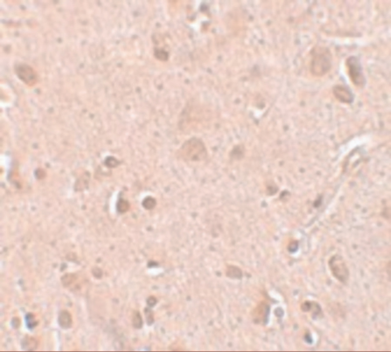 Immunohistochemistry of TINP1 in human brain tissue with TINP1 antibody at 5 ug/mL.