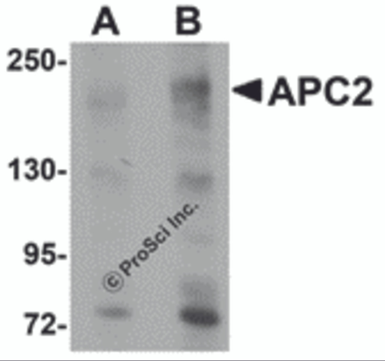 Western blot analysis of APC2 in HeLa cell lysate with APC2 antibody at (A) 1 and (B) 2 &#956;g/mL.