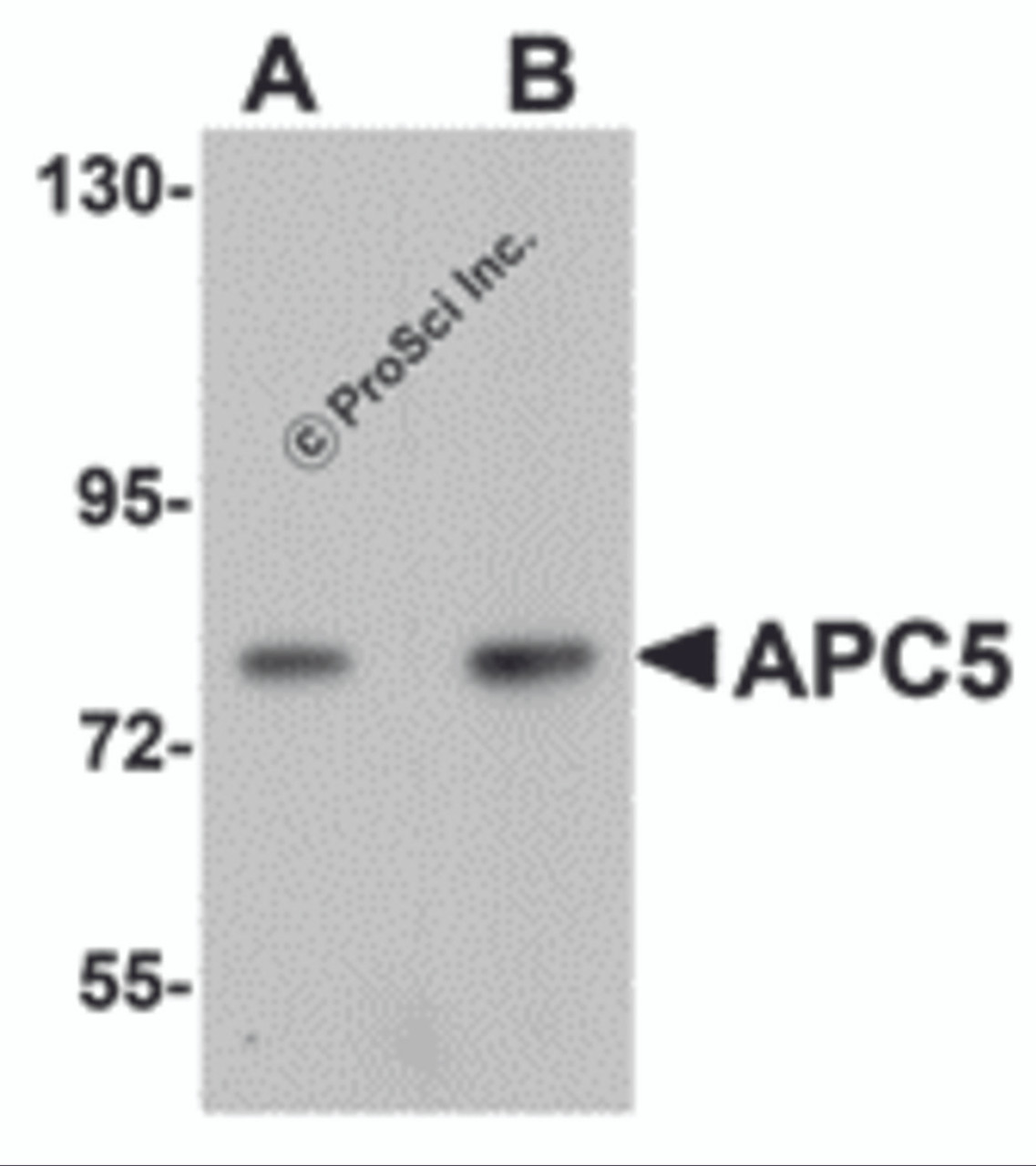Western blot analysis of APC5 in human kidney tissue lysate with APC5 antibody at (A) 1 and (B) 2 &#956;g/mL.