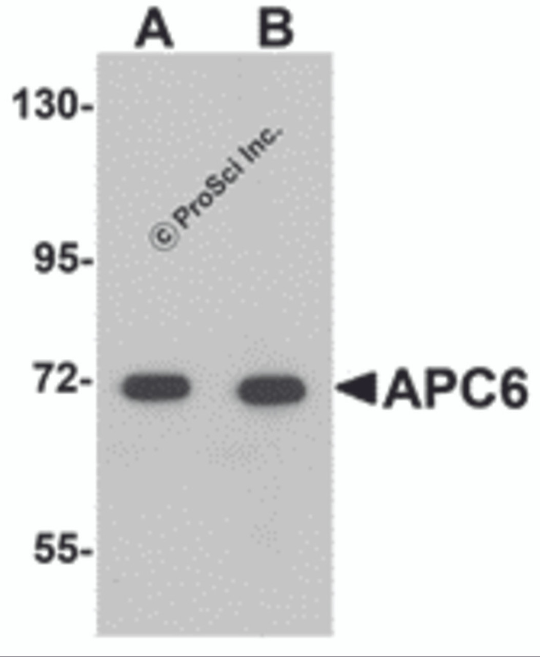 Western blot analysis of APC6 in human liver tissue lysate with APC6 antibody at (A) 1 and (B) 2 &#956;g/mL.
