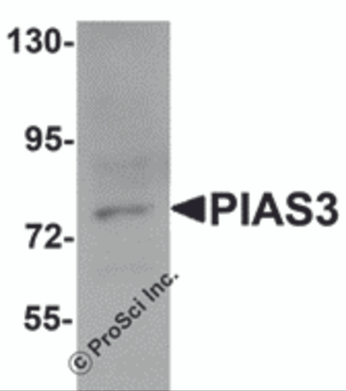 Western blot analysis of PIAS3 in K562 cell lysate with PIAS3 antibody at 1 &#956;g/mL.