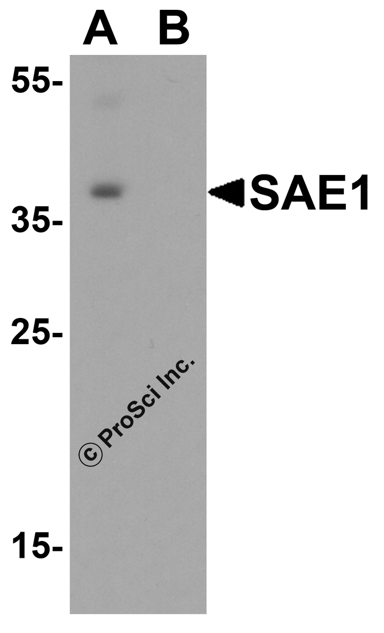 Western blot analysis of SAE1 in SK-N-SH lysate with SAE1 antibody at 0.5 &#956;g/mL in (A) the absence and (B) the presence of blocking peptide.