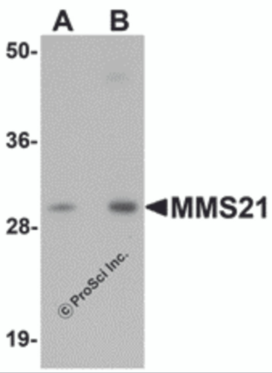 Western blot analysis of MMS21 in 293 cell lysate with MMS21 antibody at (A) 0.5 and (B) 1 &#956;g/mL.