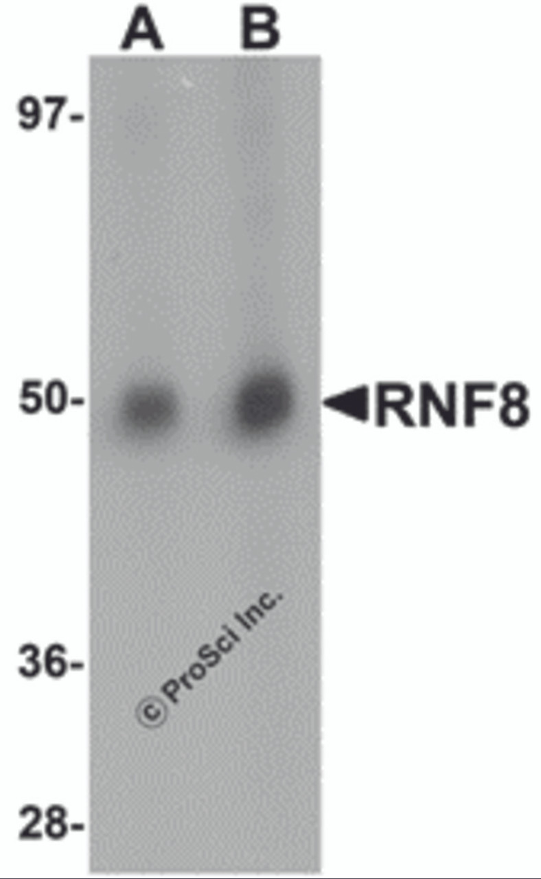 Western blot analysis of RNF8 in human lung tissue lysate with RNF8 antibody at (A) 1 and (B) 2 &#956;g/mL.