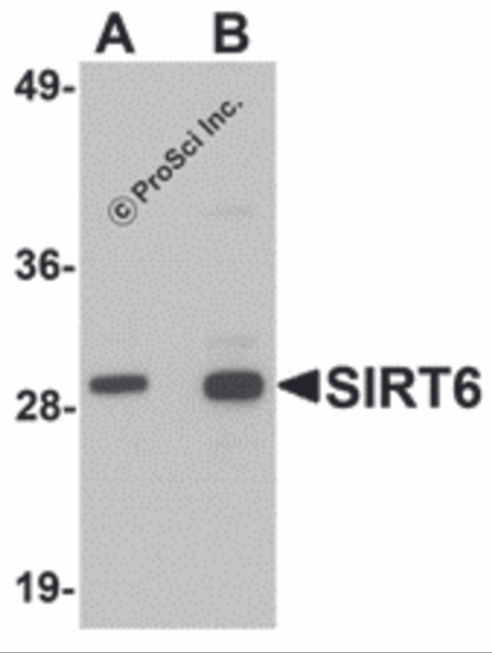Western blot analysis of SIRT6 in HeLa cell lysate with SIRT6 antibody at (A) 0.5 and (B) 1 &#956;g/mL.
