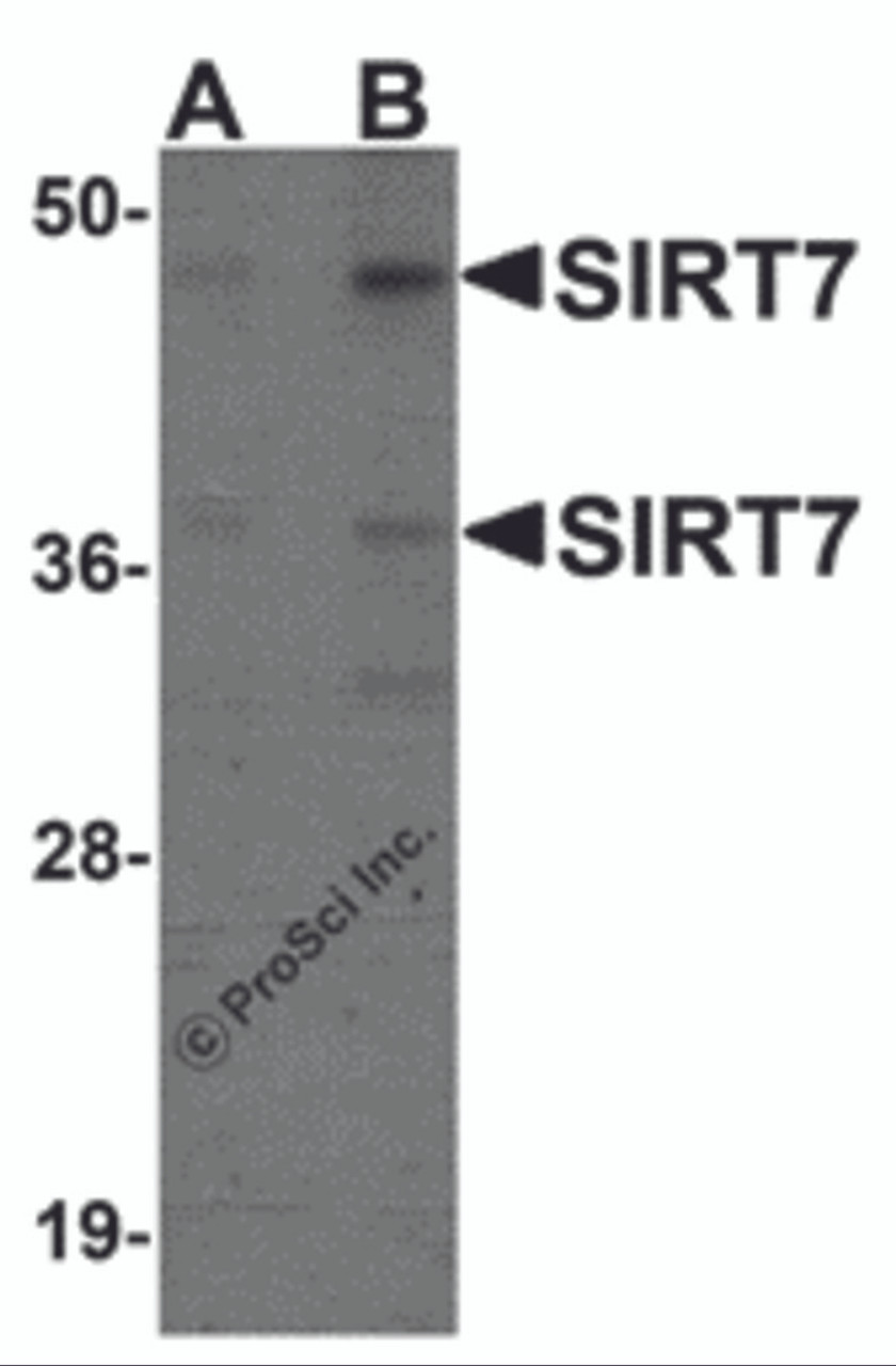 Western blot analysis of SIRT7 in 293 cell lysate with SIRT7 antibody at (A) 0.5 and (B) 1 &#956;g/mL.