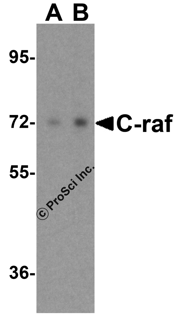Western blot analysis of C-raf in A431 cell lysate with NPC1 antibody at (A) 0.5 and (B) 1 &#956;g/mL.