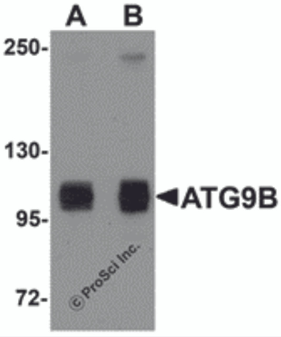 Western blot analysis of ATG9B in HeLa cell lysate with ATG9B antibody at (A) 1 and (B) 2 &#956;g/mL.