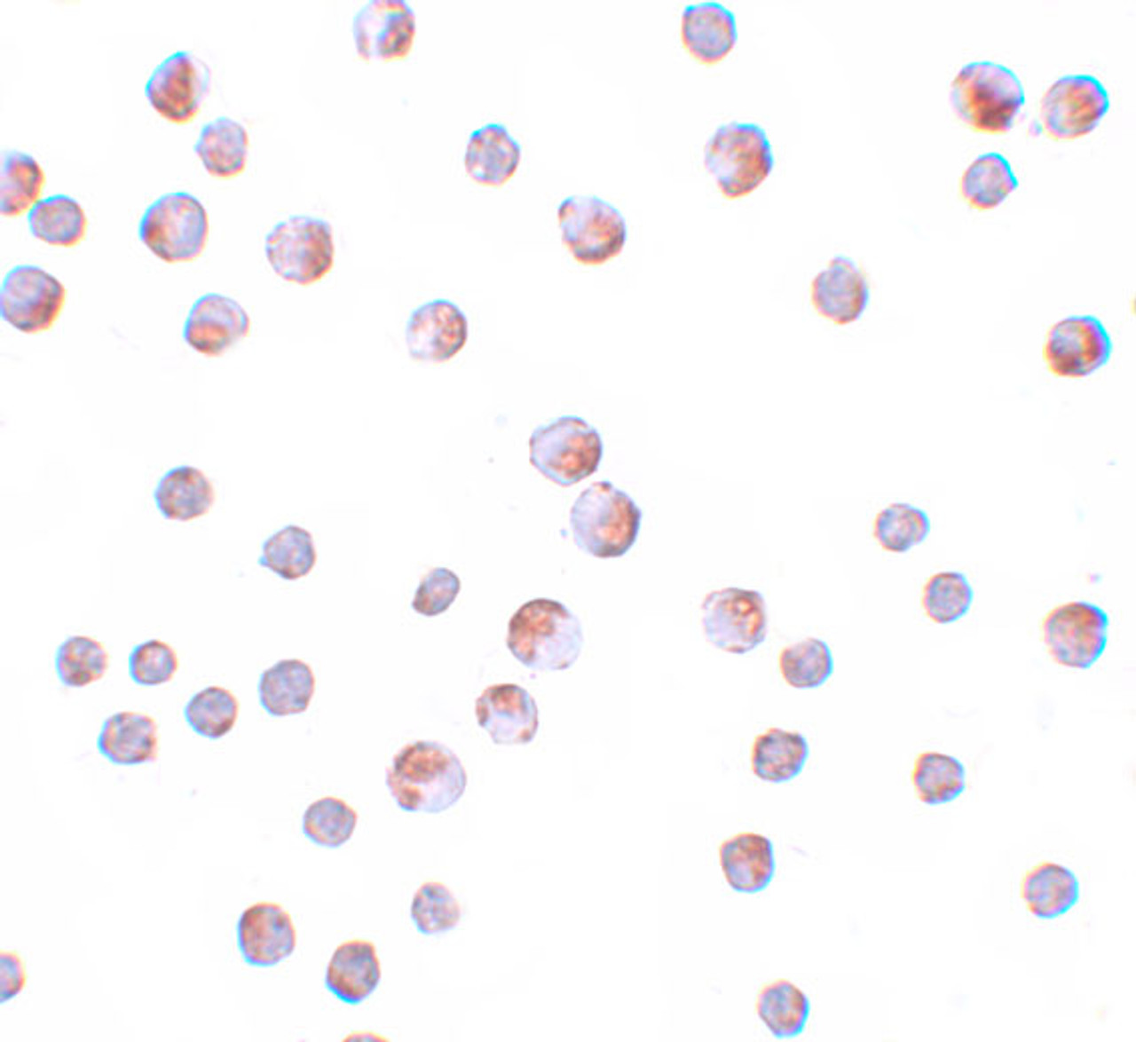 Immunocytochemistry of ATG9B in HeLa cells with ATG9B antibody at 10 ug/mL.