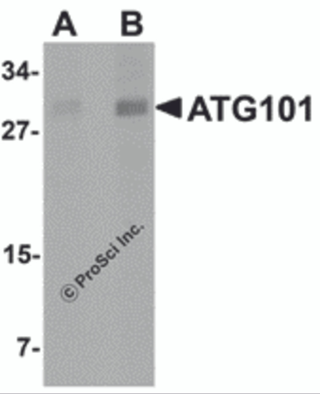 Western blot analysis of ATG101 in human liver tissue lysate with ATG101 antibody at (A) 1 and (B) 2 &#956;g/mL.