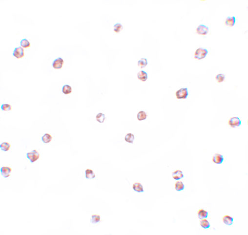 Immunocytochemistry of FOXO3 in A-20 cells with FOXO3 antibody at 4 ug/mL.