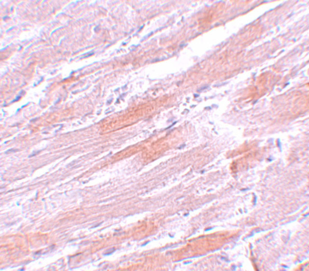 Immunohistochemistry of IDH2 in mouse heart tissue with IDH2 antibody at 5 ug/mL.