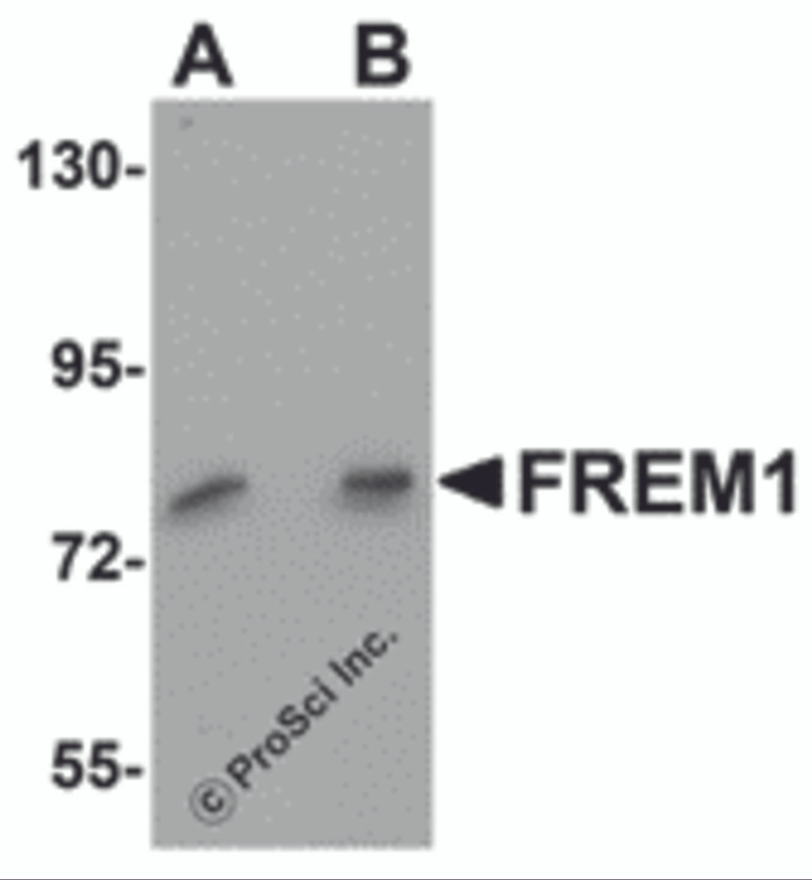 Western blot analysis of FREM1 in K562 cell lysate with FREM1 antibody at (A) 0.5 and (B) 1&#956;g/mL.