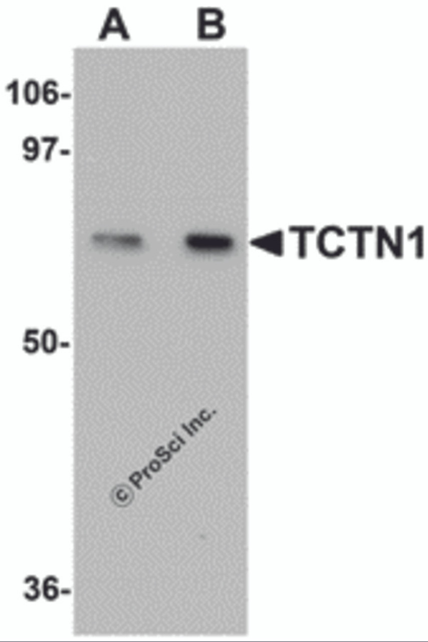 Western blot analysis of TCTN1 in mouse kidney tissue lysate with TCTN1 antibody at (A) 1 and (B) 2&#956;g/mL.