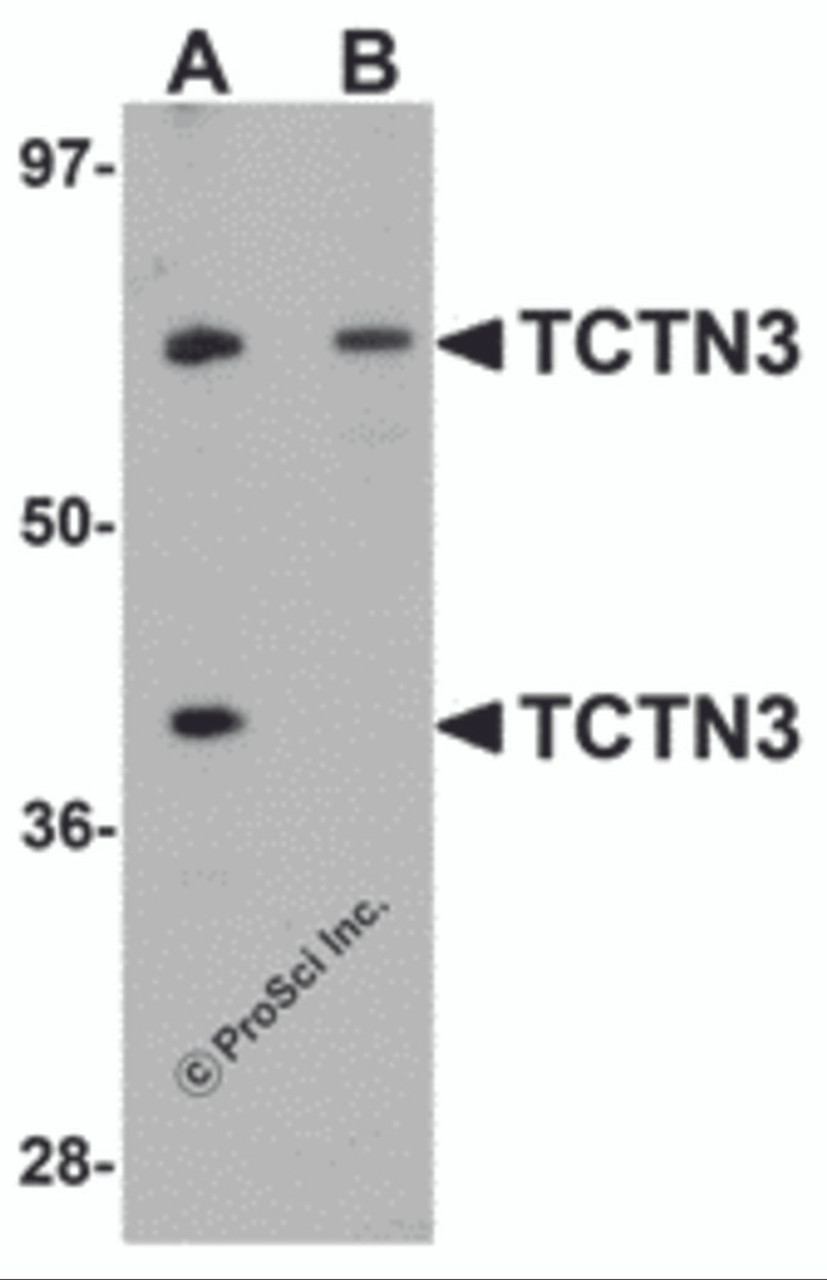 Western blot analysis of TCTN3 in HeLa cell lysate with TCTN3 antibody at (A) 1 and (B) 2&#956;g/mL.