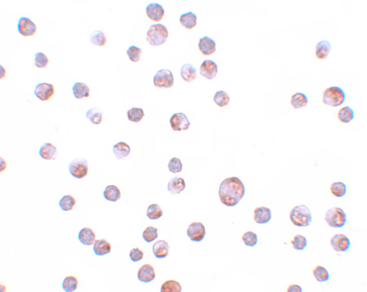 Immunocytochemistry of ZC3HAV1 in HeLa cells with ZC3HAV1 antibody at 20 ug/mL.