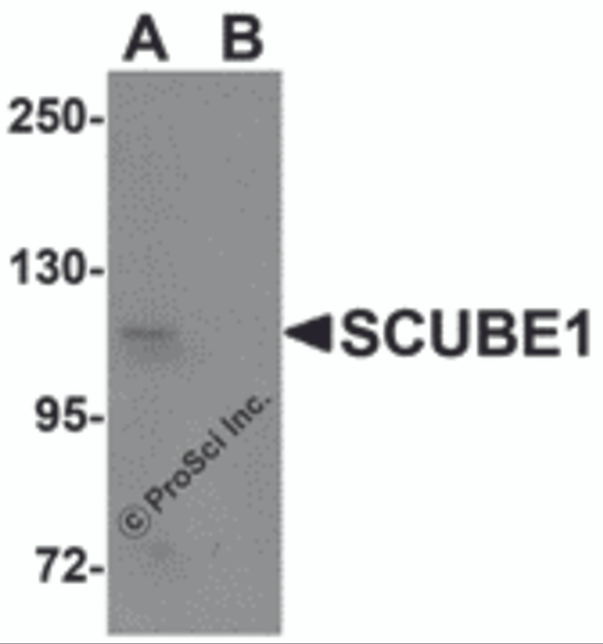 Western blot analysis of SCUBE1 in Daudi cell lysate with SCUBE1 antibody at 1 &#956;g/mL in (A) the absence and (B) the presence of blocking peptide.