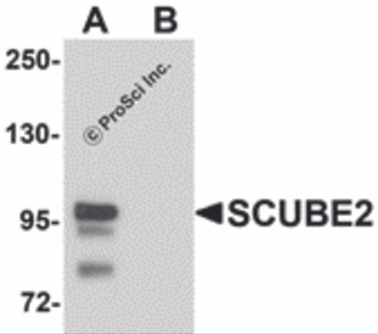 Western blot analysis of SCUBE2 in Daudi cell lysate with SCUBE2 antibody at 1 &#956;g/mL in (A) the absence and (B) the presence of blocking peptide.