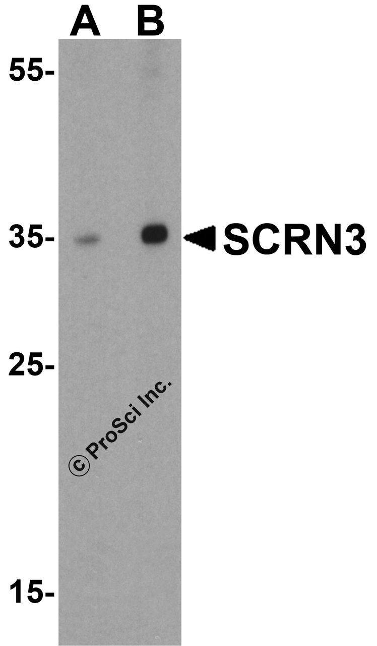 Western blot analysis of SCRN3 in human breast tissue lysate with SCRN3 antibody at (A) 1 and (B) 2 &#956;g/mL.
