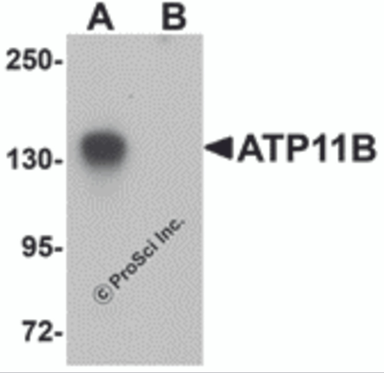 Western blot analysis of ATP11B in K562 cell tissue lysate with ATP11B antibody at 1 &#956;g/mL in (A) the absence and (B) the presence of blocking peptide.
