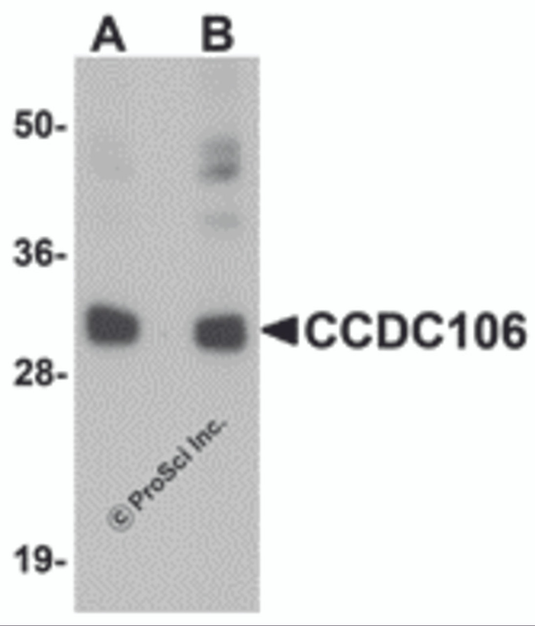 Western blot analysis of CCDC106 in human brain tissue lysate with CCDC106 antibody at (A) 0.5 and (B) 1 &#956;g/mL.
