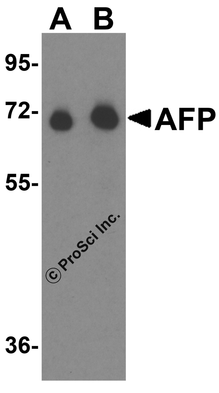 Western blot analysis of AFP in fetal human liver tissue lysate with AFP antibody at (A) 1 &#956;g/mL and (B) 2 &#956;g/mL.