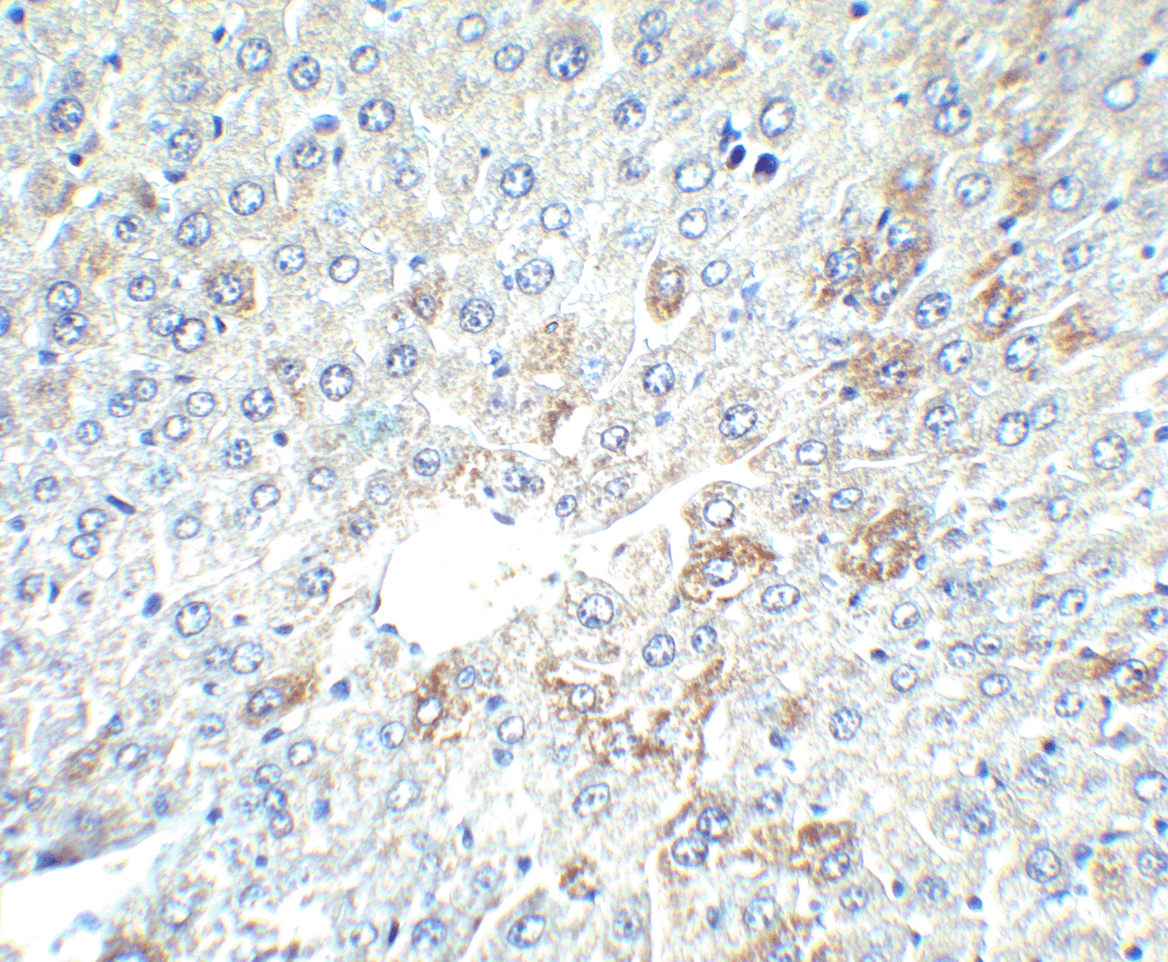 Immunohistochemistry of AFP in mouse liver tissue with AFP antibody at 2.5 ug/ml.
