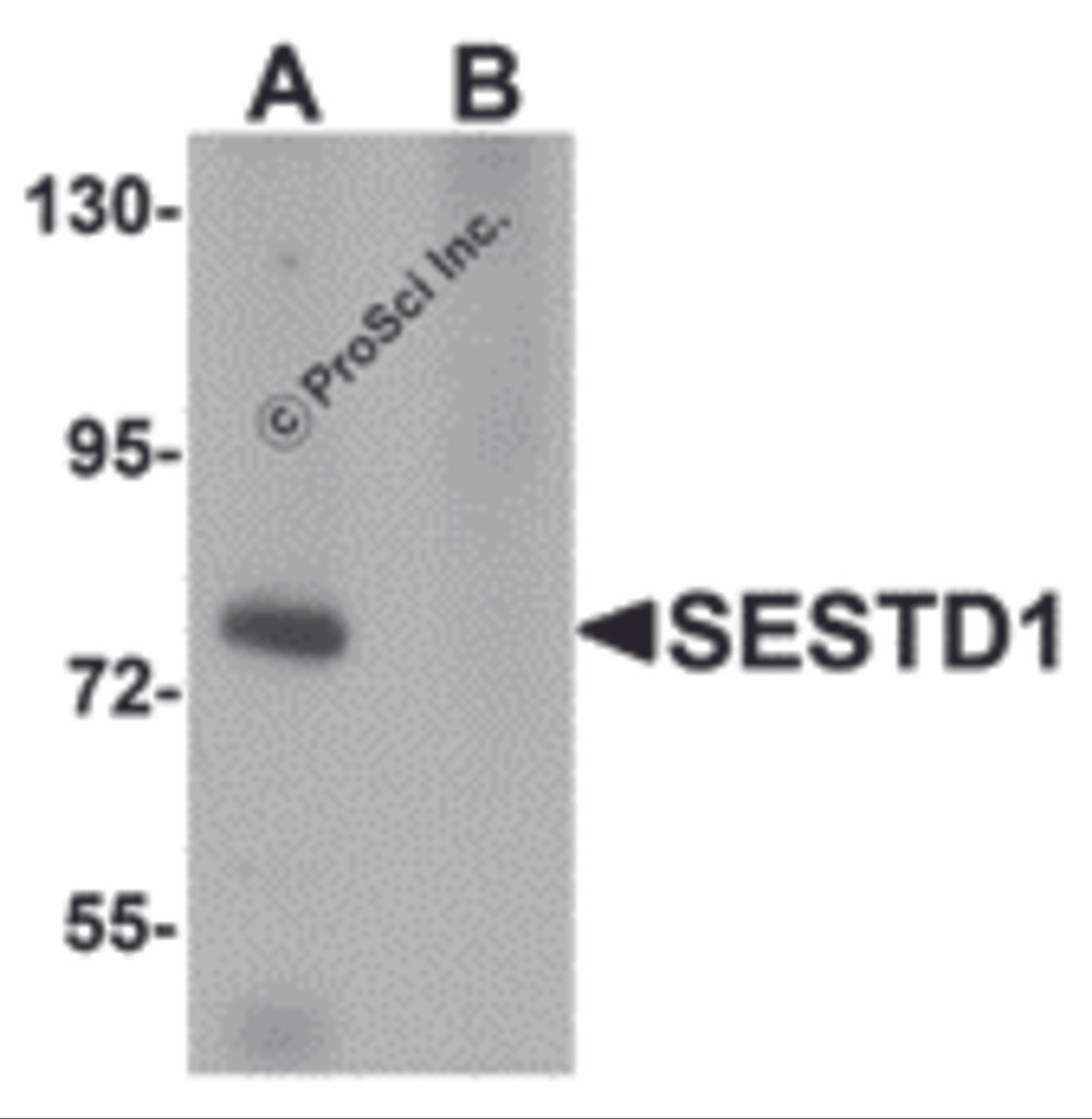 Western blot analysis of SESTD1 in rat brain tissue lysate with SESTD1 antibody at 1 &#956;g/mL in (A) the absence and (B) the presence of blocking peptide.