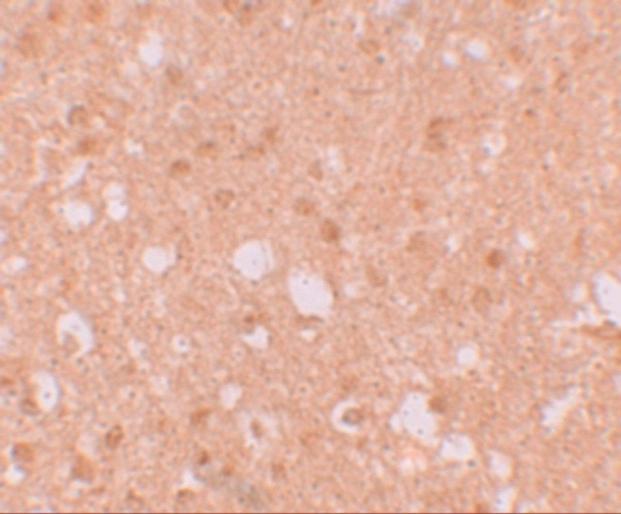 Immunohistochemistry of TRIM71 in human brain tissue with TRIM71 antibody at 5 ug/mL.